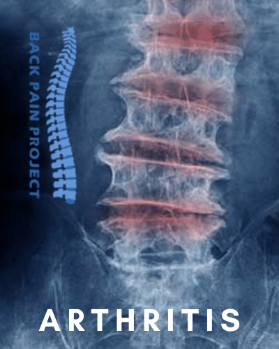 The Back Pain Project help arthritis pain Stamford Darien Norwalk New Canaan 203-656-3638
