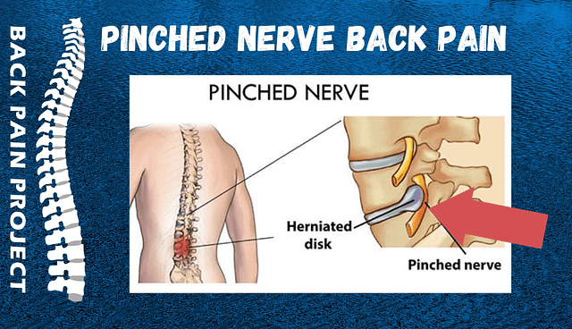 The Back Pain Project Stamford Darien Norwalk New Canaan pinched nerve back pain