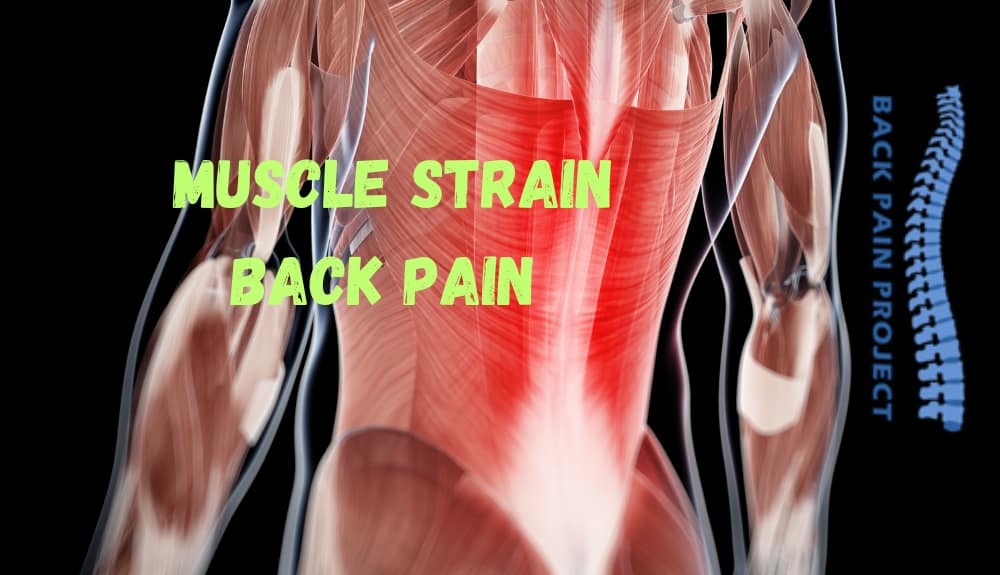 Back pain from Muscle strain - The Back Pain Project