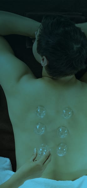 CUPPING HELPS BACK PAIN